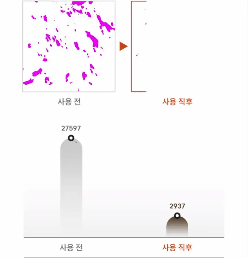 [1등 두피세럼 / 특허 맥주효모] 나인밀라 맥주효모 두피영양제 앰플 팩 120ml 단독 기획 (+샴푸 60ml 증정) 상세페이지 16